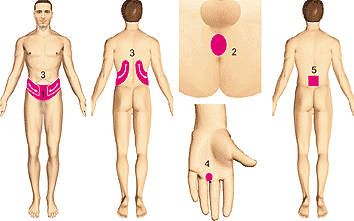 ДиаДЭНС-ПКМ и  Боль внизу живота, в области наружных половых органов (простатит, уретрит, орхит, орхоэпидидимит)