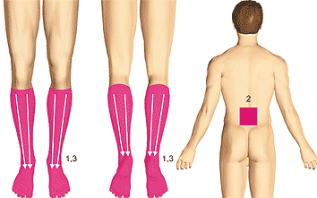 ДиаДЭНС-ПКМ и  Боль в ногах, "перемежающаяся хромота", диабетическая ангиопатия, вибрационная болезнь, болезнь Рейно (заболевания периферических артерий)